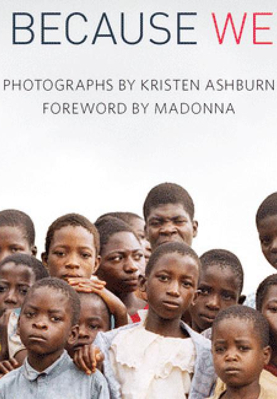 VARIM ÇÜNKÜ VARIZ