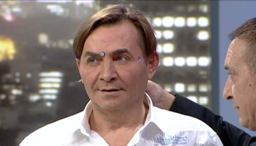 Akupunktur Uygulaması