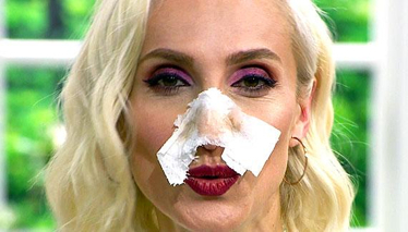 Siyah noktalar için “Burun Bandı”