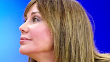 "Yüzümde hiç estetik yok"