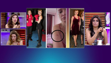 Meral Kaplan kavga olayını canlı yayında açıkladı!