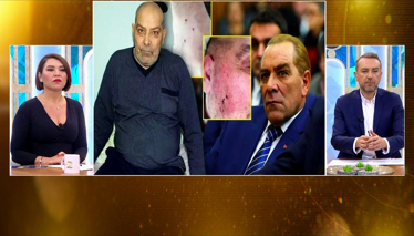 Oyuncu Göksel Kaya eşinden gördüğü şiddeti anlattı!